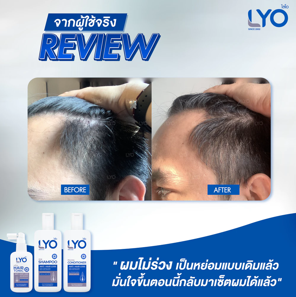lyo รีวิว รีวิวลูกค้า ไลโอ ดีไหม pantip