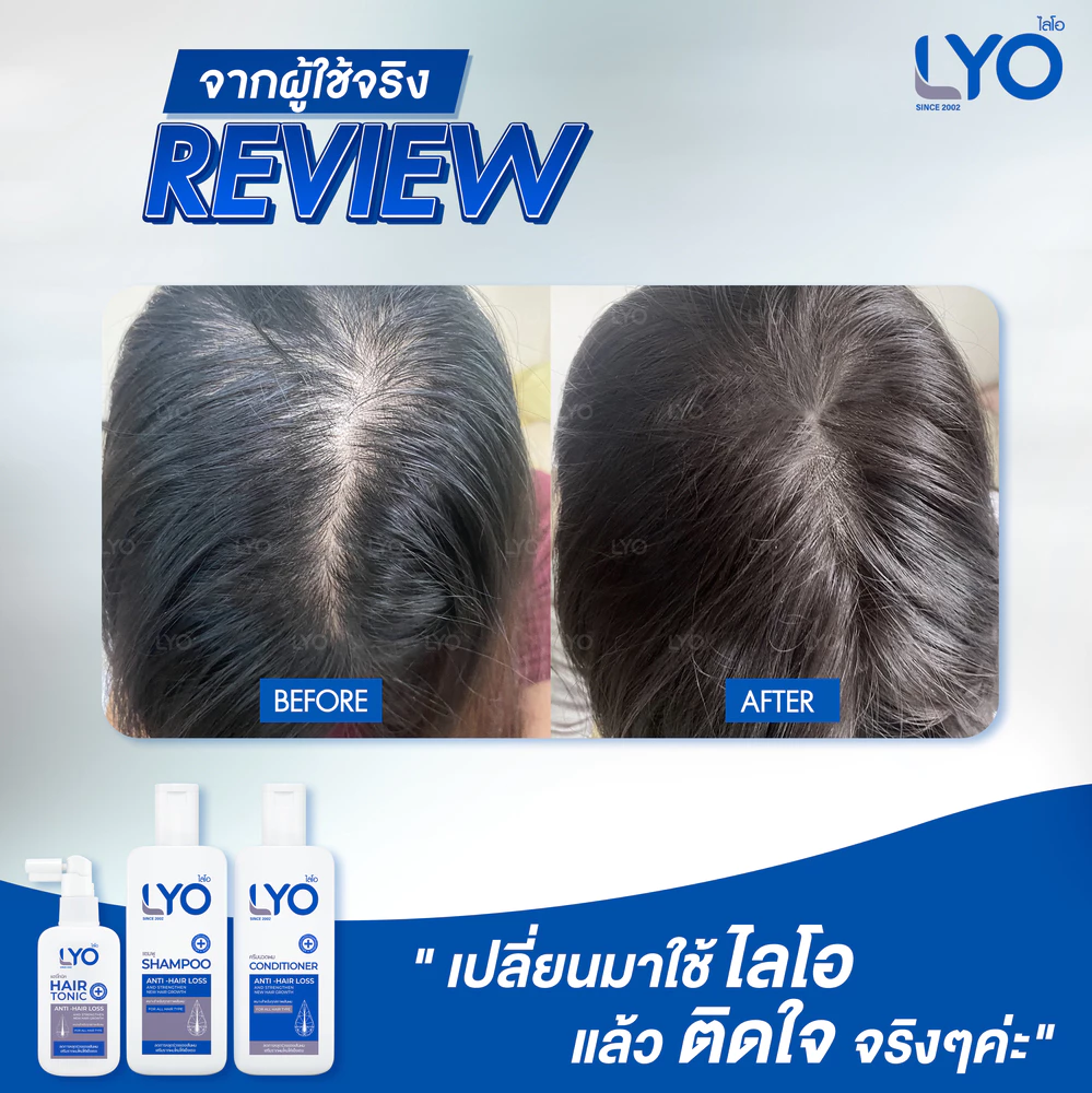 แชมพูไลโอ รีวิว lyo ซื้อที่ไหน