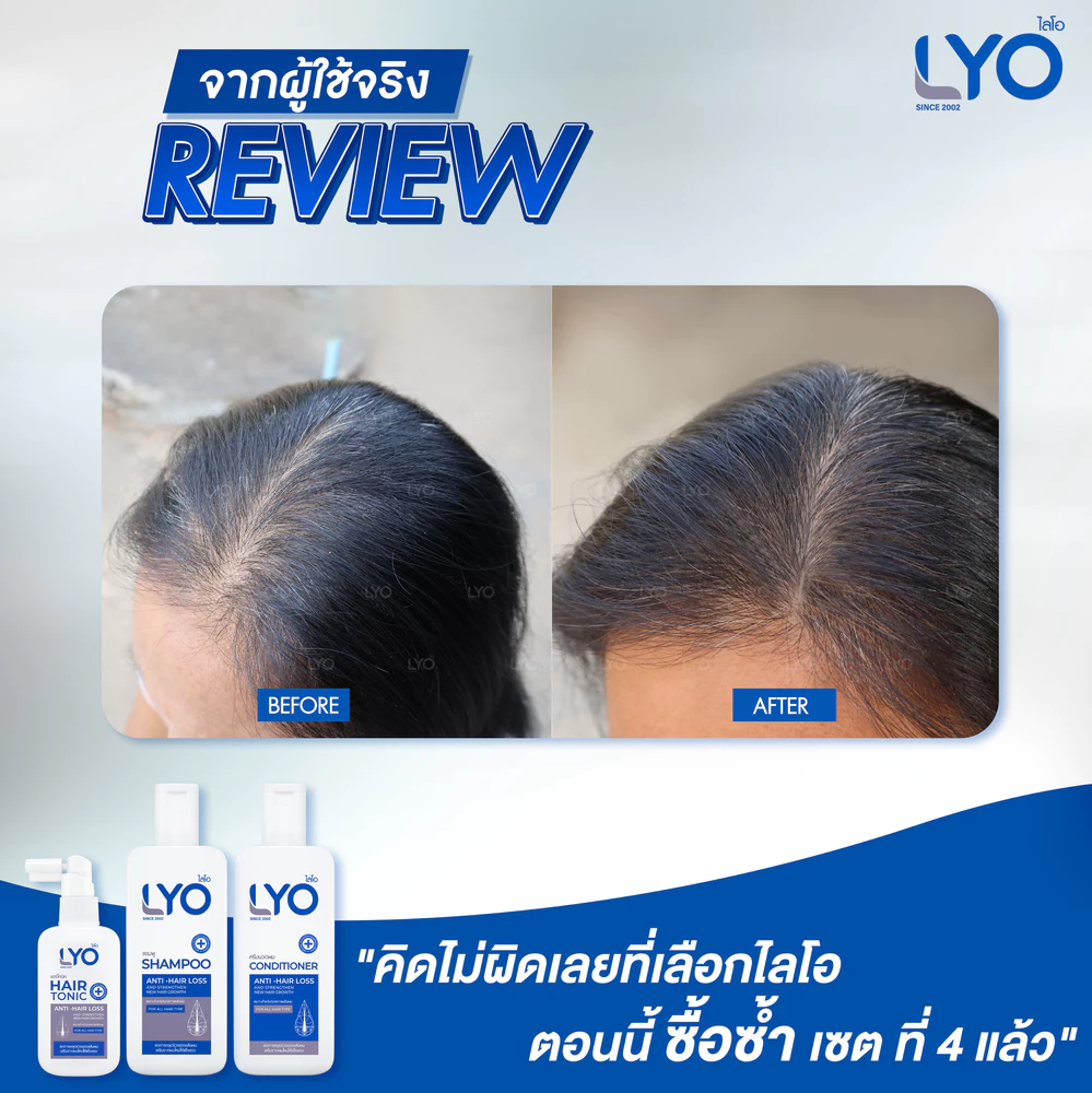 ไลโอ ราคา lyo hair tonic ดีไหม pantip